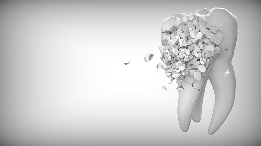 Animated version of tooth decaying. 